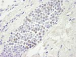 Detection of human MCM4 by immunohistochemistry.