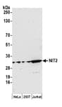 Detection of human NIT2 by western blot.