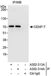 Detection of human CENP-T by western blot of immunoprecipitates.