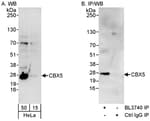 Detection of human CBX5 by western blot and immunoprecipitation.