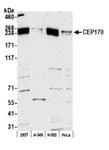 Detection of human CEP170 by western blot.