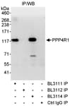 Detection of human PPP4R1 by western blot of immunoprecipitates.