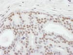 Detection of human ASH2 by immunohistochemistry.
