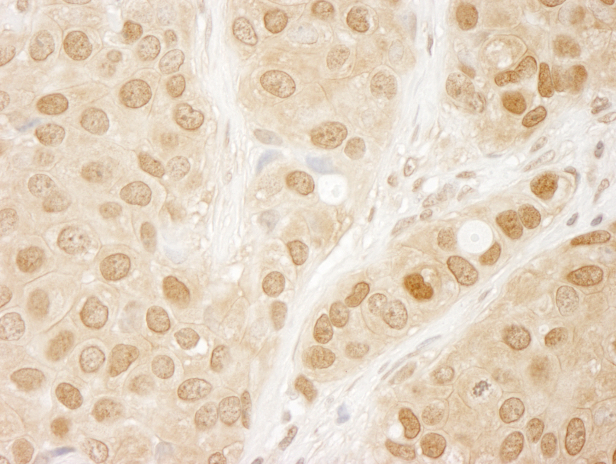 Rabbit anti-AKT1 IHC Antibody