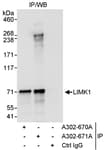Detection of human LIMK1 by western blot of immunoprecipitates.