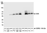 Detection of human CD38 by western blot.