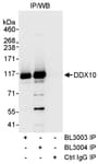 Detection of human DDX10 by western blot of immunoprecipitates.