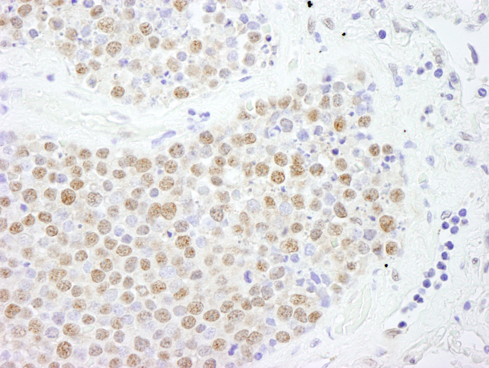 Rabbit anti-FOXK2 IHC Antibody