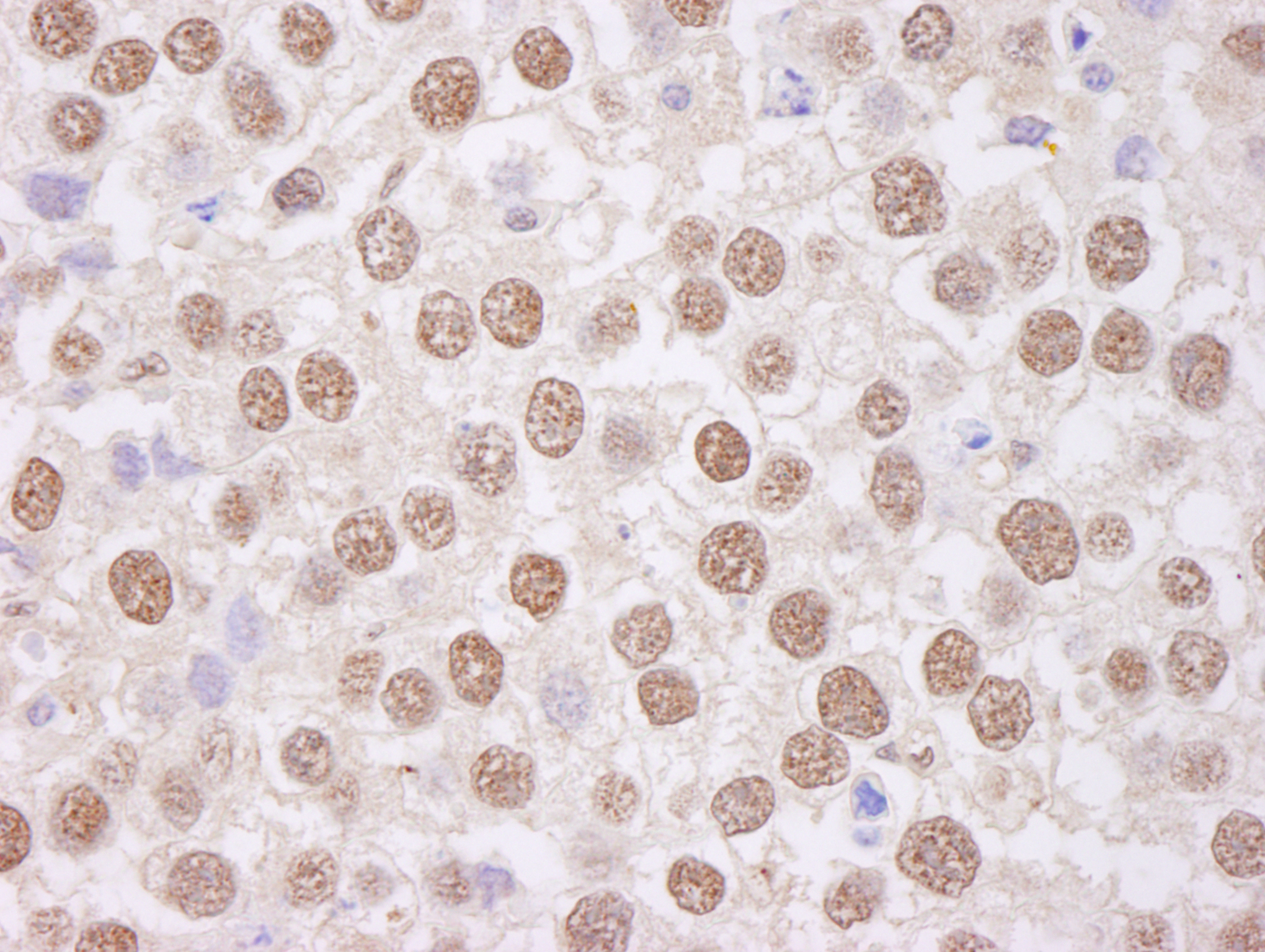Detection of human TAFII68 by immunohistochemistry.