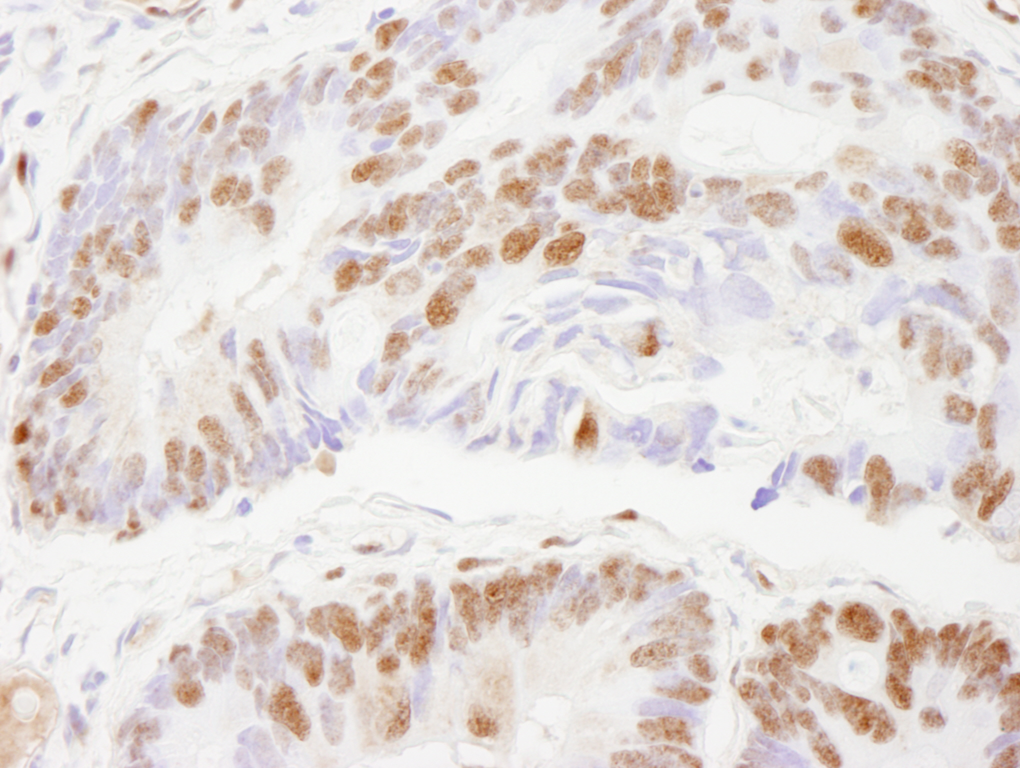 Rabbit anti-ZNF295 IHC Antibody