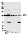 Detection of human CP110 by western blot.