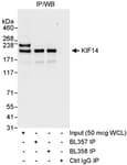 Detection of human KIF14 by western blot and immunoprecipitation.
