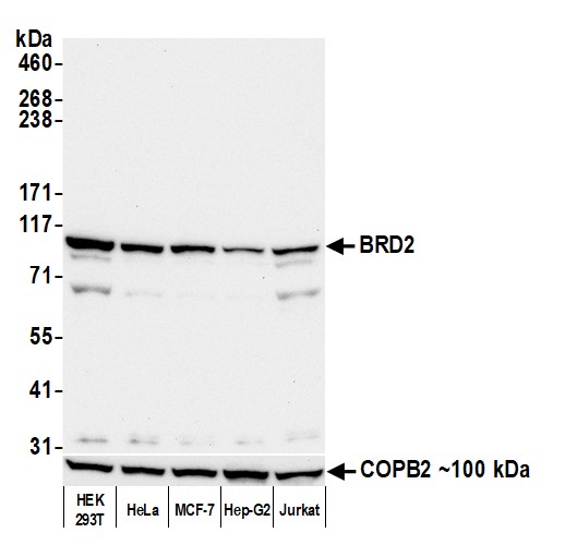 Mouse anti-BRD2 Monoclonal Antibody [12C2E4]