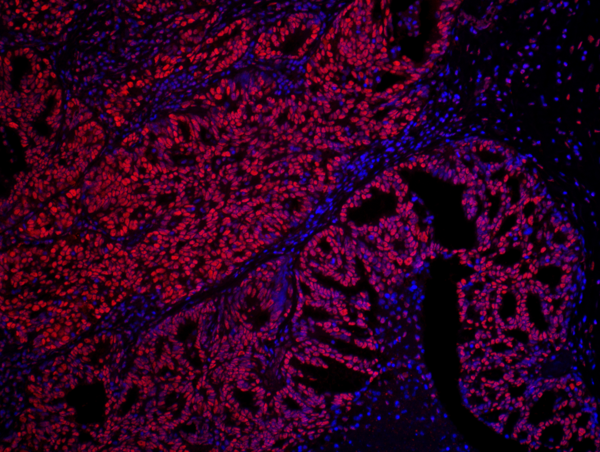 Rabbit anti-SET IHC Antibody