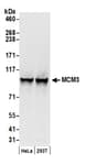 Detection of human MCM3 by western blot.