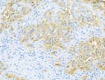 Detection of human EpCAM by immunohistochemistry.