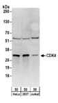 Detection of human CDK4 by western blot.