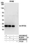 Detection of human SPCS2 by western blot of immunoprecipitates.