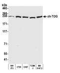 Detection of mouse ch-TOG by western blot.