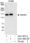 Detection of human ANKIB1 by western blot of immunoprecipitates.