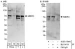Detection of human MIER3 by western blot and immunoprecipitation.