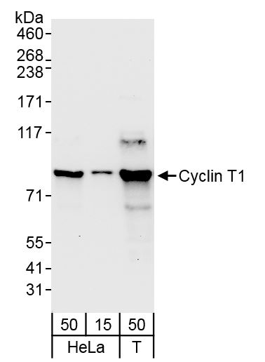 Detection of human Cyclin T1 by western blot.