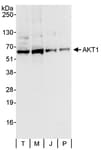 Detection of human AKT1 by western blot.