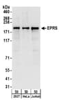 Detection of human EPRS by western blot.