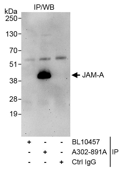 Detection of human JAM-A by western blot of immunoprecipitates.