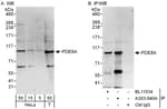 Detection of human PDE8A by western blot and immunoprecipitation.