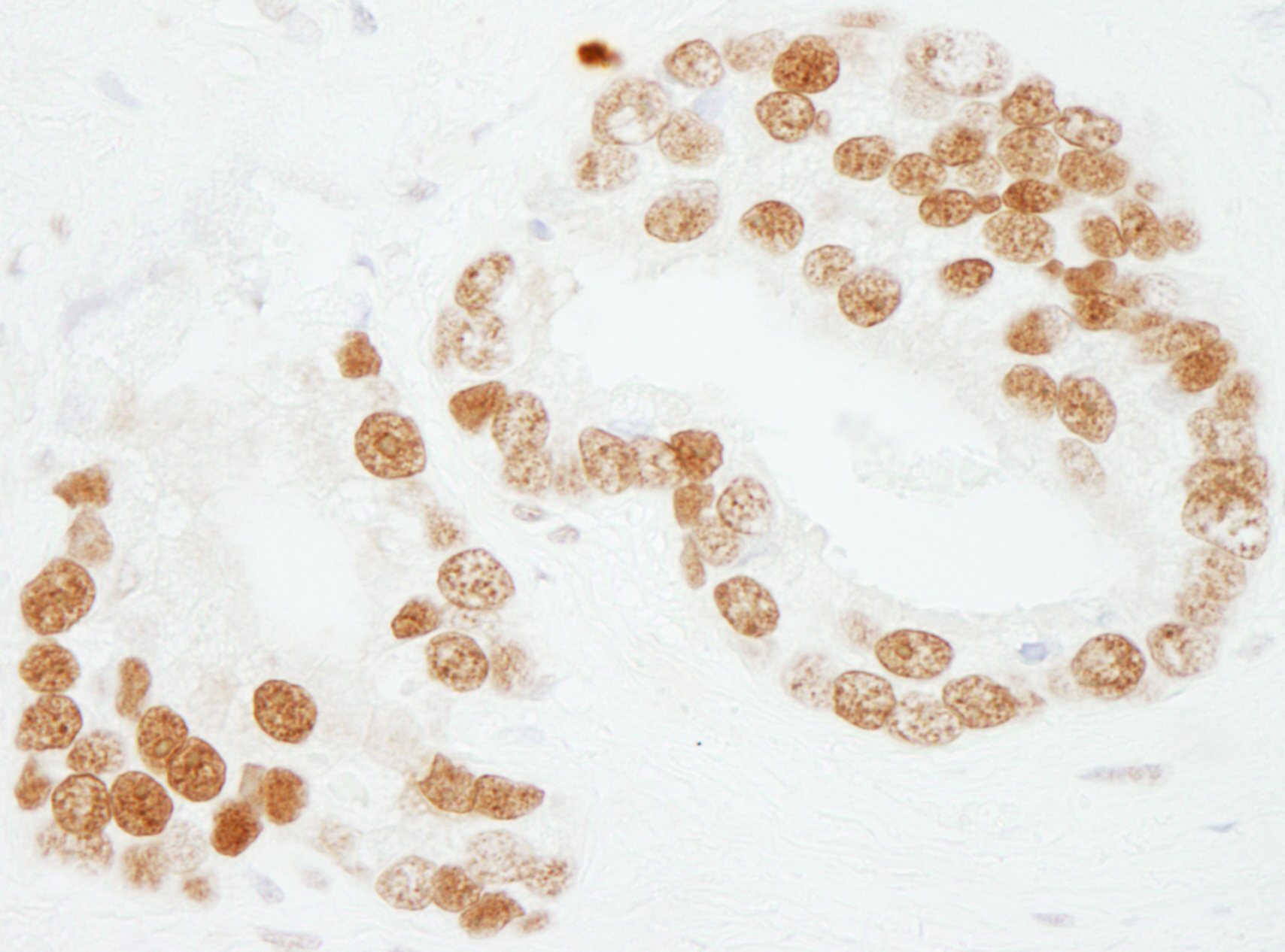 Detection of human PC4 by immunohistochemistry.