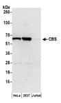 Detection of human CBS by western blot.