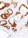 Detection of human AMACR by immunohistochemistry.
