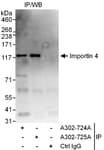 Detection of human Importin 4 by western blot of immunoprecipitates.