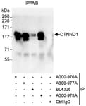 Detection of human CTNND1 by western blot of immunoprecipitates.