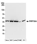 Detection of human and mouse PRPF38A by western blot.