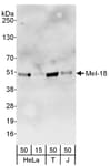 Detection of human Mel-18 by western blot.