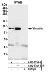 Detection of human Vinculin by western blot of immunoprecipitates.
