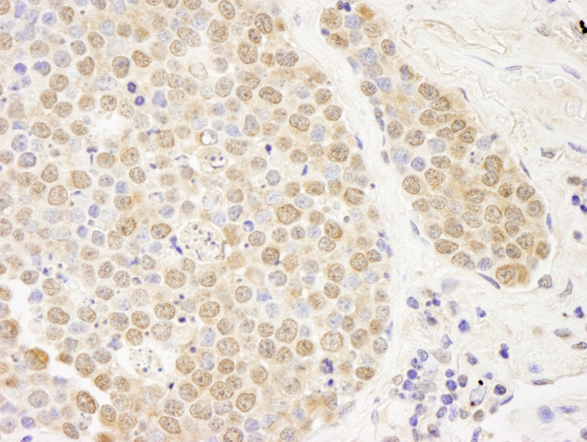 Rabbit anti-PARP10 IHC Antibody