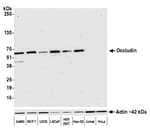 Detection of human Occludin by western blot.