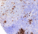 Detection of human CD138 by immunohistochemistry.