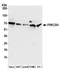 Detection of human and mouse PRKCSH by western blot.