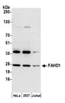 Detection of human FAHD1 by western blot.