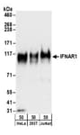 Detection of human IFNAR1 by western blot.