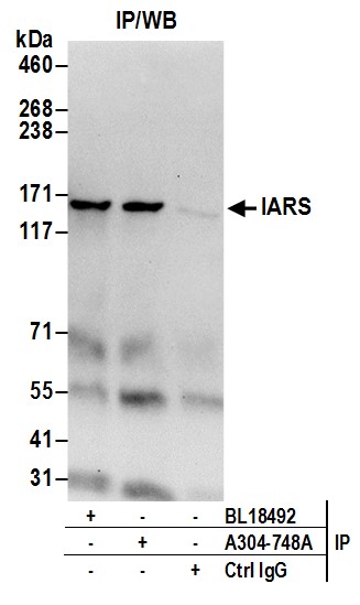 Detection of human IARS by western blot of immunoprecipitates.