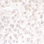 Detection of mouse hPrp3p by immunohistochemistry.