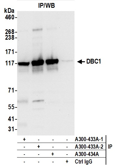 Detection of human DBC1 by western blot of immunoprecipitates.