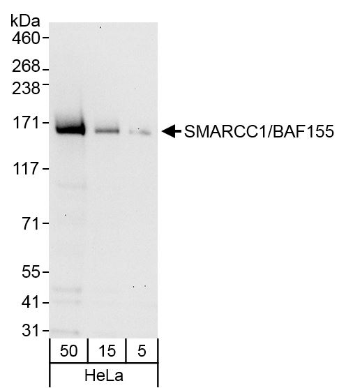 Detection of human SMARCC1/BAF155 by western blot.