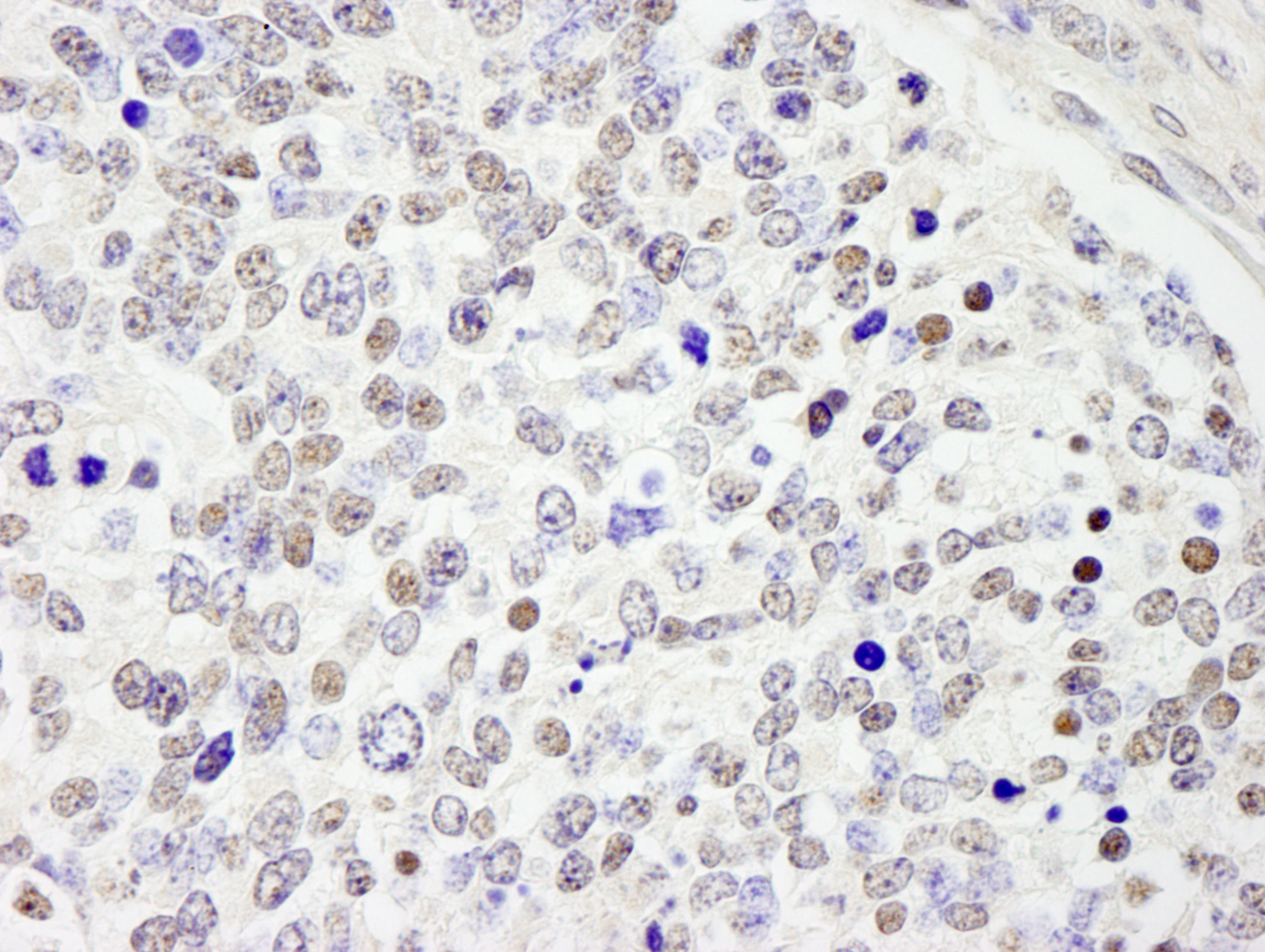 Detection of mouse CDC25c by immunohistochemistry.