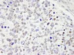 Detection of mouse CDC25c by immunohistochemistry.